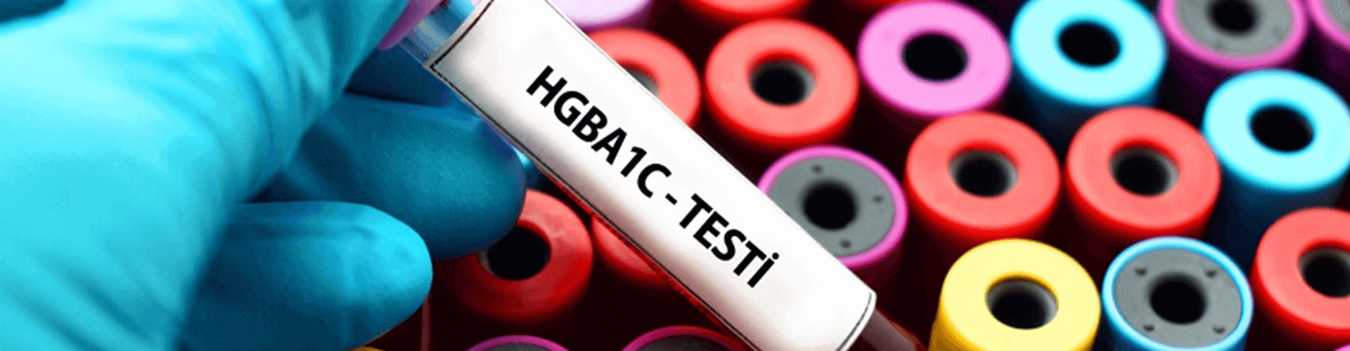 HGBA1C Testi